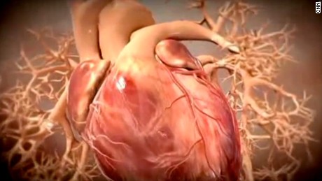 What is heart failure, heart attack and cardiac arrest?