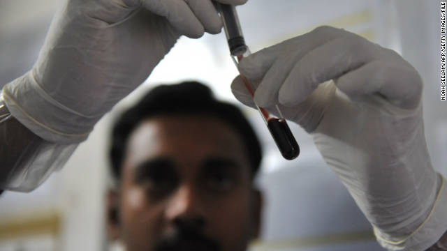 Fewer young adults get tested for HIV, here's why