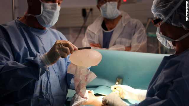 How surgeons build new breasts