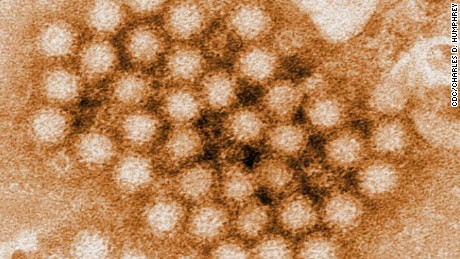Norovirus: The most common stomach bug