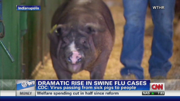 Cdc Cases Of New Swine Flu Strain Rising Cnn