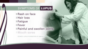How one woman bravely manages lupus