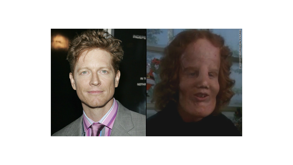 The makeover for Eric Stoltz in 1985's "Mask" was astounding as Stoltz portrayed Rocky Dennis, a boy trying to live a normal life with the disorder lionitis. The transformation picked up an Oscar for best makeup.