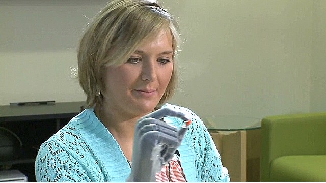 pkg Aimee Copeland Bionic Hands_00002327.jpg