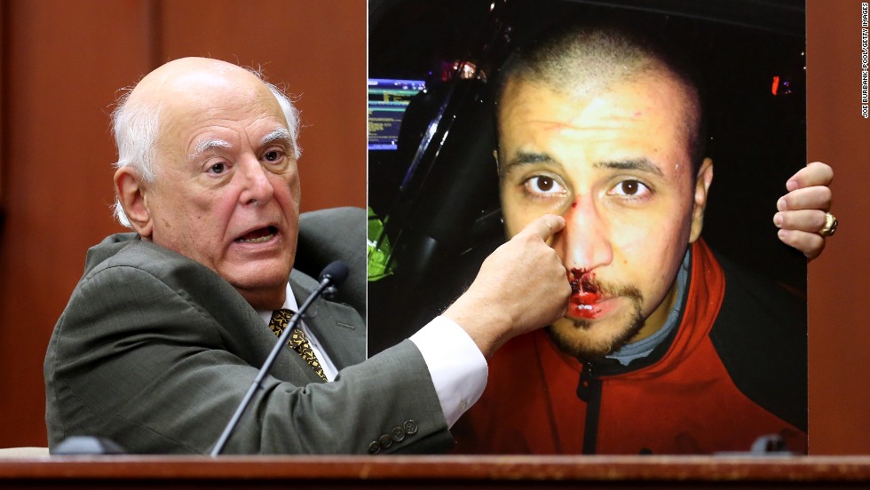 Dr. Vincent Di Maio, a forensic pathologist and gunshot wound expert, describes Zimmerman&#39;s injuries while testifying for the defense Tuesday, July 9.