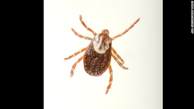 A tick bite temporarily paralyzes a 3-year-old child