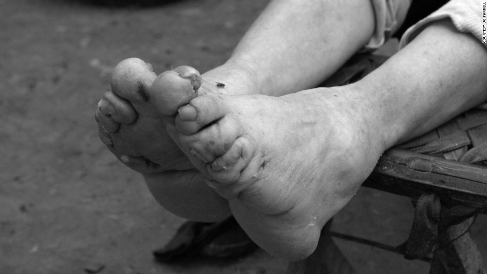 Work Not Sex The Real Reason Chinese Women Bound Their Feet Cnn