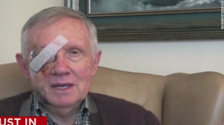 Reid Working From Home After Bone Breaking Fall Cnnpolitics