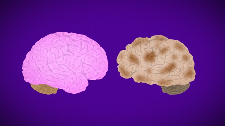 The fight against Alzheimer's: 우리는 지금 어디에?