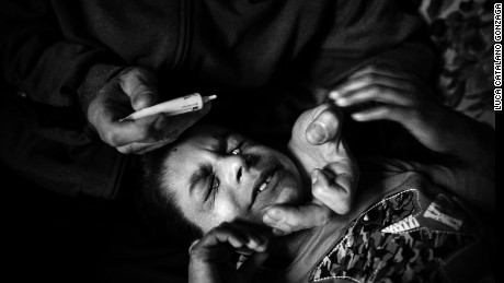 Living in shadows: A child&#39;s rare disorder