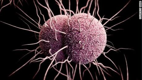 Gonorrhea rates in Australia up 63% in 5 years, data show