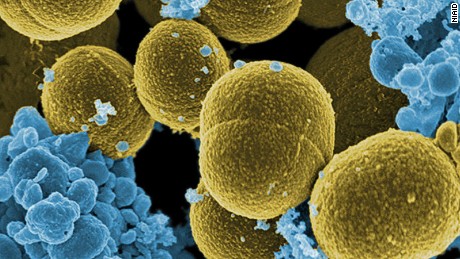 Progress on fatal staph infections is slowing down; CDC calls for increased prevention
