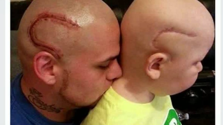 Dad gets scar tattoo to support son who's fighting cancer ...
