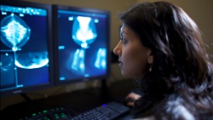 Doctors still divided on when women should start mammograms