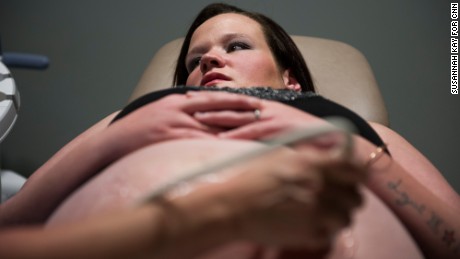 Jessica Hill, 28, of Morristown, Tennessee, receives an ultrasound at the University of Tennessee Medical Center's High Risk Obstetrics unit in Knoxville, Tennessee, on March 23, 2017. Hill chose Dr. Tower's to help her detox from opiates during her pregnancy. She is due to give birth the week of April 12, 2017. 