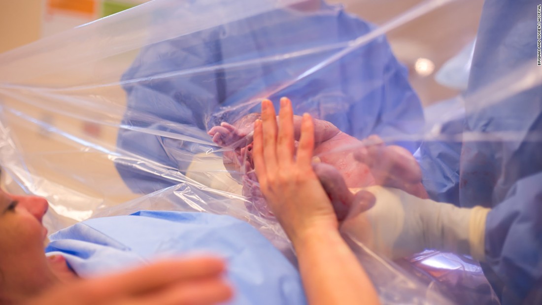 نتيجة بحث الصور عن ‪"gentle," Cesarean-section‬‏