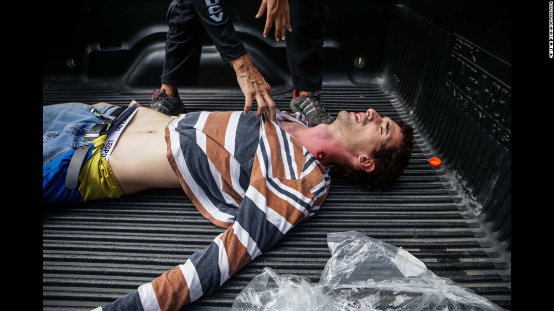 A protester wounded by a pellet gun receives attention July 30 during a demonstration against the vote for a Constituent Assembly.