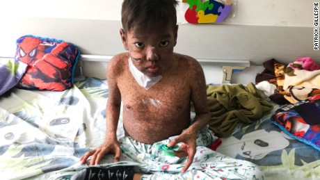 'We are in the hospital suffering': A child's life cut short amid Venezuela crisis