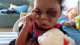 Little girl opens the world&#39;s eyes to Yemen conflict