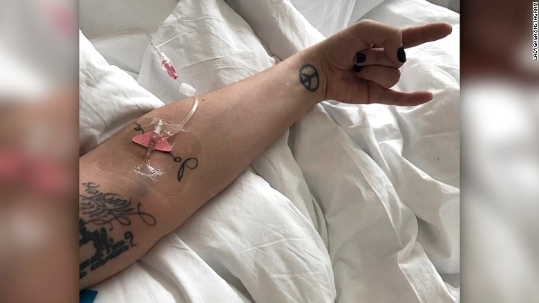 Lady Gaga hospitalized, cancels concert (2017)