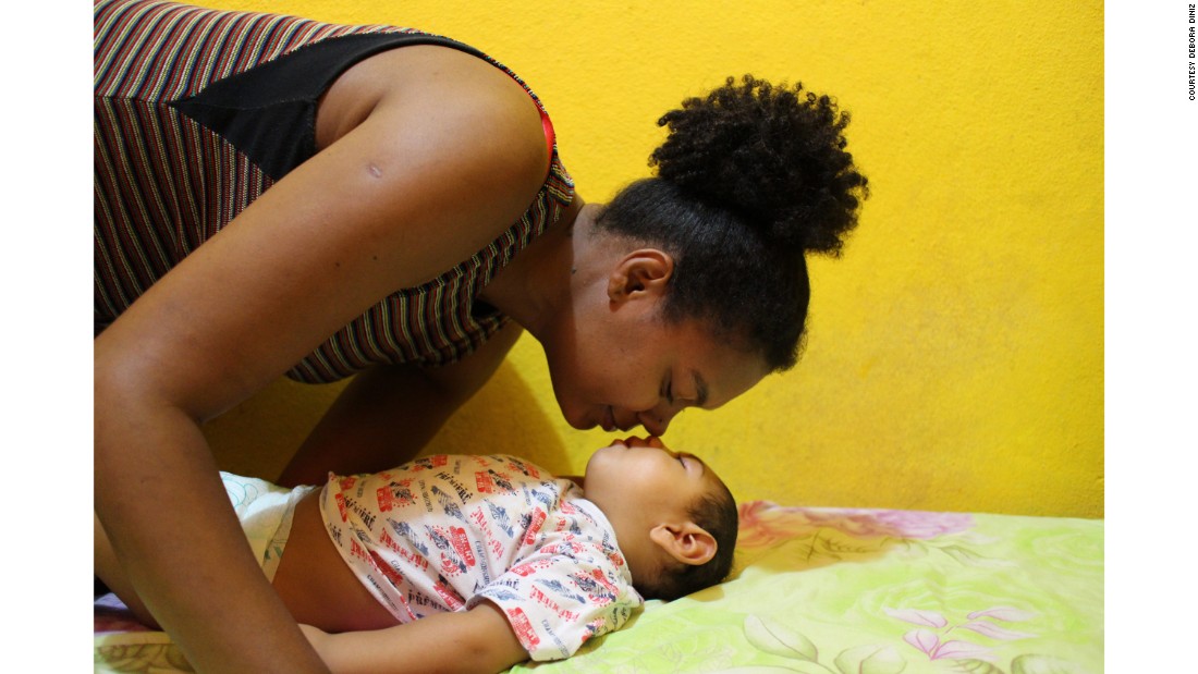 Rosana Sampaio da Silva and her son, Samuel Emanuel, who has microcephaly. Rosana quit her job as a teacher, but her husband&#39;s salary cannot pay for medications or visits to early stimulation treatments in Maceió, an hour away.