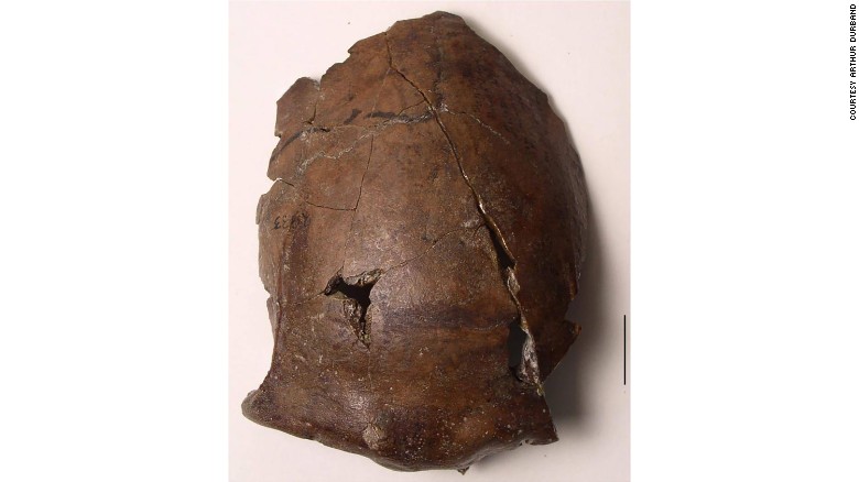 The 6,000-year-old skull found in Papua New Guinea