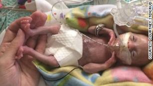 Born before 22 weeks, &#39;most premature&#39; baby is now thriving