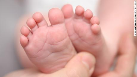 France launches national survey of babies born with missing or poorly trained limbs