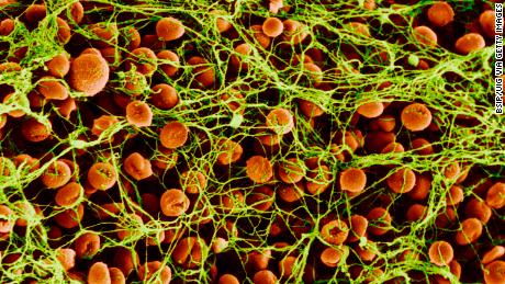 Formation of a blood clot: Sufferers of Haemophilia A do not have the gene allowing blood to clot. 