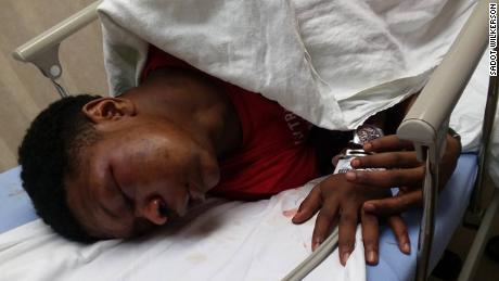 Parents outraged after Alabama boy beaten during arrest
