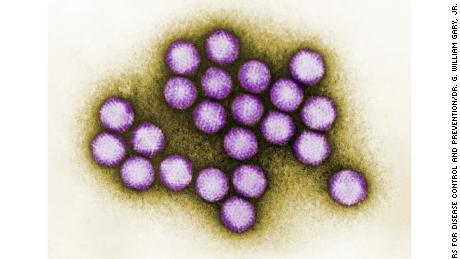 Health officials seek answers to deadly viral infection in New Jersey 