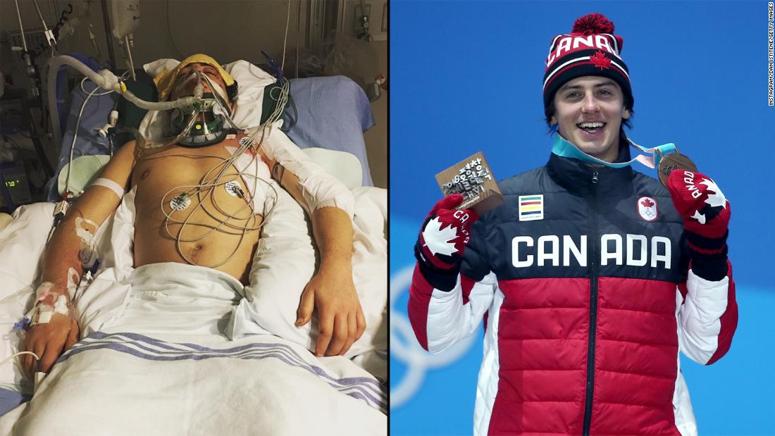 Canadian Snowboarder Mark McMorris Wins Olympic Bronze After Near-death ...