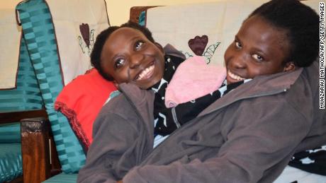 Tanzanian conjoined twins die at age 21