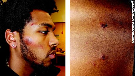 The photos included in the trial show the injuries that Brown allegedly suffered at the hands of the police. 