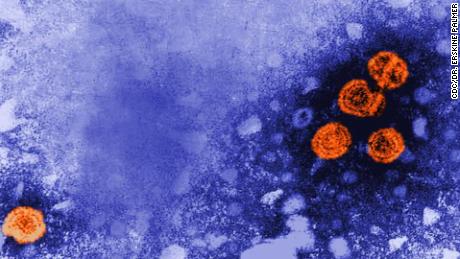 CDC panel recommends hepatitis A vaccination through age 18 and for HIV patients