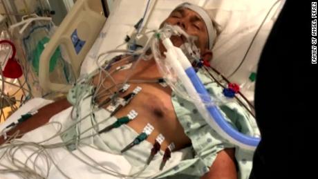 New Jersey crabber could lose life or limbs & # 39; after bacterial infection