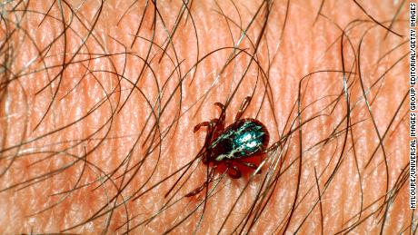 Wisconsin reports first death from Rocky Mountain spotted fever
