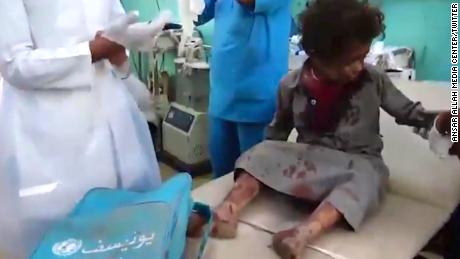 Footage from Houthi-run Al-Masirah TV appears to show a boy, carrying a UNICEF backpack, being treated for injuries. 