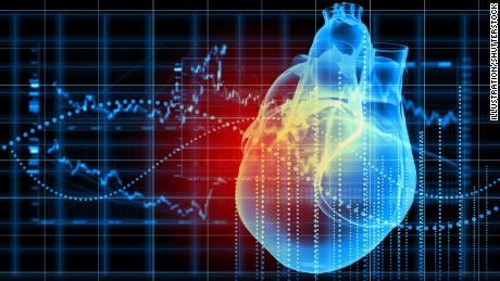 According to a study, many sudden cardiac deaths related to silent heart attacks preceded