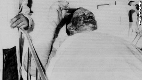 Vernon Dahmer, a civil rights leader who was burned when the Nightriders set fire to his home and shop, died in Hattiesburg on January 10, 1966. 