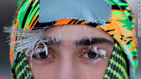   Frost covers part of the face of a University of Minnesota student Tuesday 