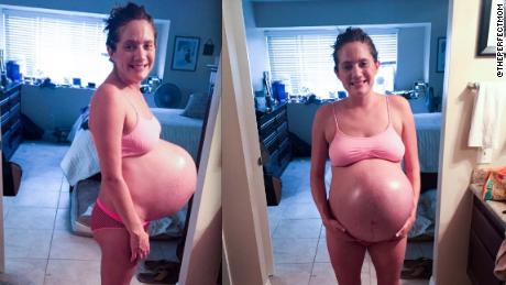 Désirée Fortin's 105-pound body had to stretch as her three babies grew to five pounds each.