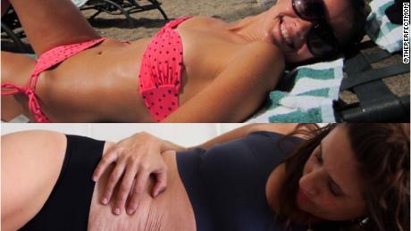 Fortin shares his body before and after wearing and giving birth to triplets