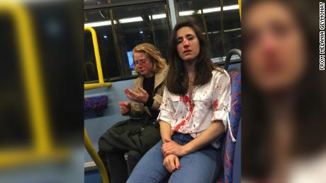 Lesbian couple viciously beaten in homophobic attack on London bus