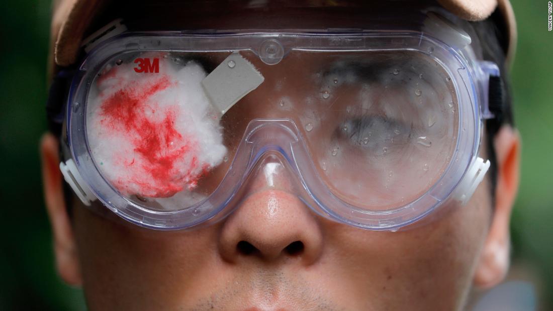 A protester participates in a march on Saturday, 8月 17. His eye is covered with red gauze, referencing a woman who was allegedly shot in the eye with a beanbag round during clashes between protesters and police.