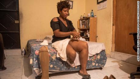 Professor Nirva Saint-Louis, who was injured in the earthquake, puts on a prosthesis at her home in Port-au-Prince in January 2020. Ten years after the earthquake, many Haitians continue to live with the weight of physical and psychological trauma. 