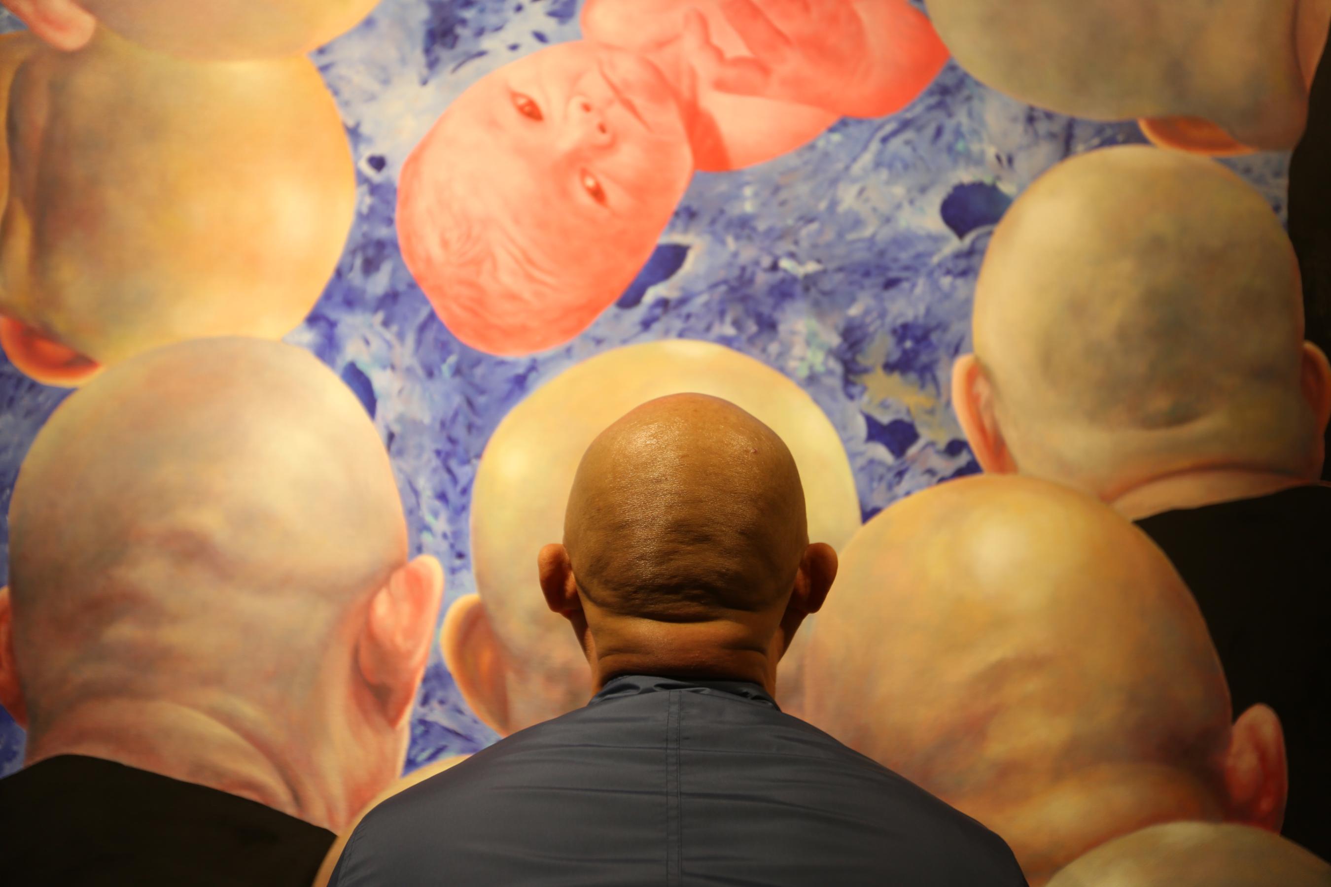 As hair loss rises, bald men in Asia grapple with cultural stigmas - CNN  Style