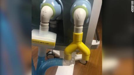 Ein y-förmiger Splitter, der zu Hause gedruckt und dann in Krankenhäusern verwendet werden kann, um die Kapazität begrenzter Beatmungsgeräte in US-Krankenhäusern zu erweitern.