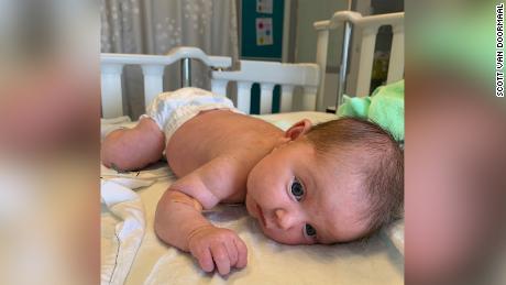 A family is trying to raise over $  2 million to give their baby a gene therapy treatment to save her life