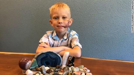 Bridger Walker, 6, saved his sister from a dog attack.